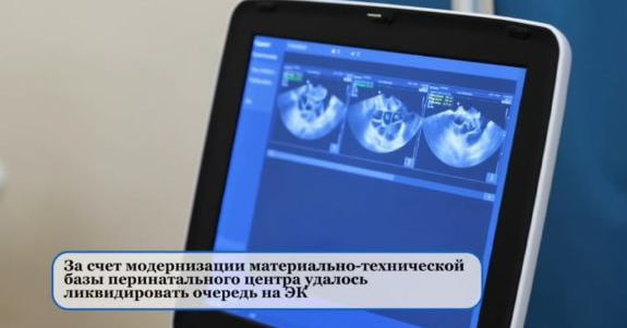 Более тысячи саратовских пар бесплатно подготовились к ЭКО