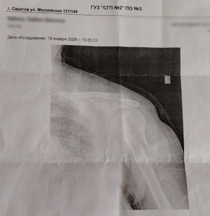 В Саратове пенсионерка сломала плечо из-за падения в автобусе