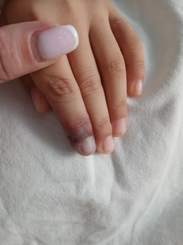 Саратовские врачи спасли ребенка с редким аутоиммунным заболеванием