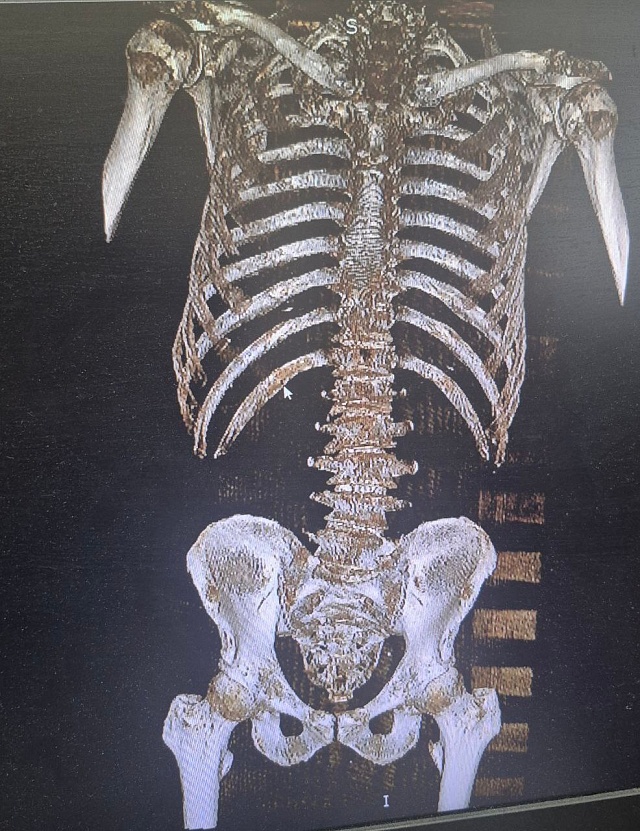 Балаковец упал с "Эйфелевой башни", но остался жив