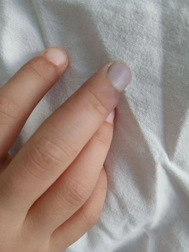 Саратовские врачи спасли ребенка с редким аутоиммунным заболеванием