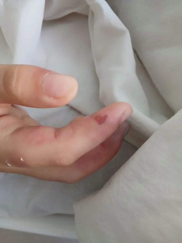 Саратовские врачи спасли ребенка с редким аутоиммунным заболеванием