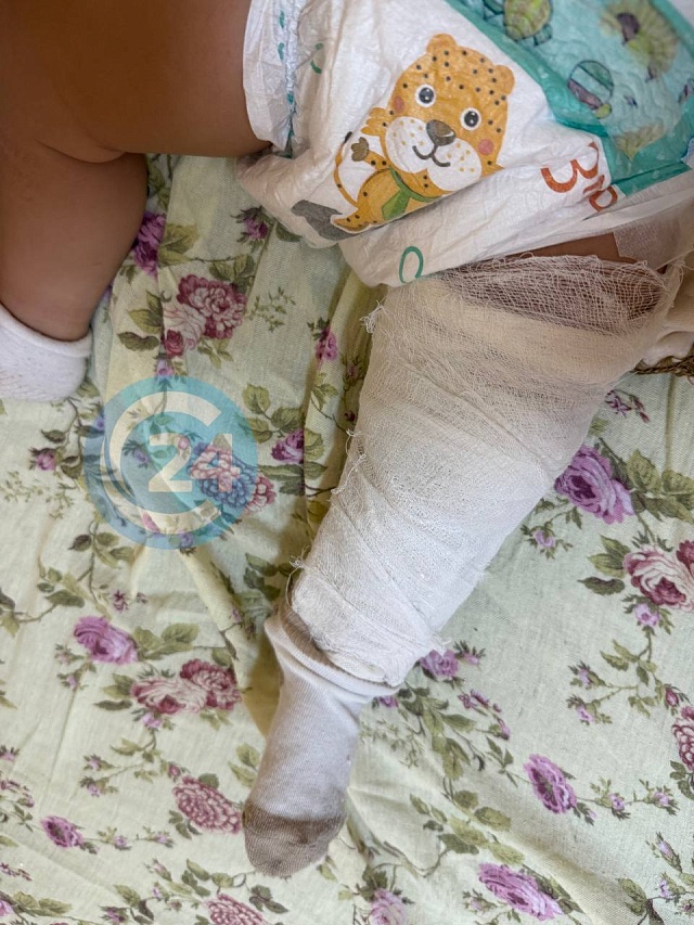 Под Саратовом "Фольксваген" сбил отца с семимесячной дочерью в коляске