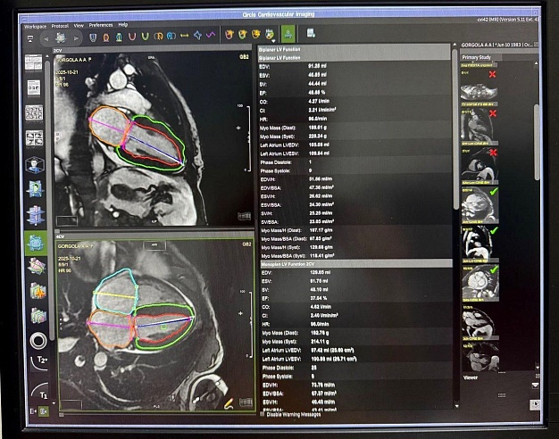 В энгельсской больнице уже полгода проводят МРТ сердца