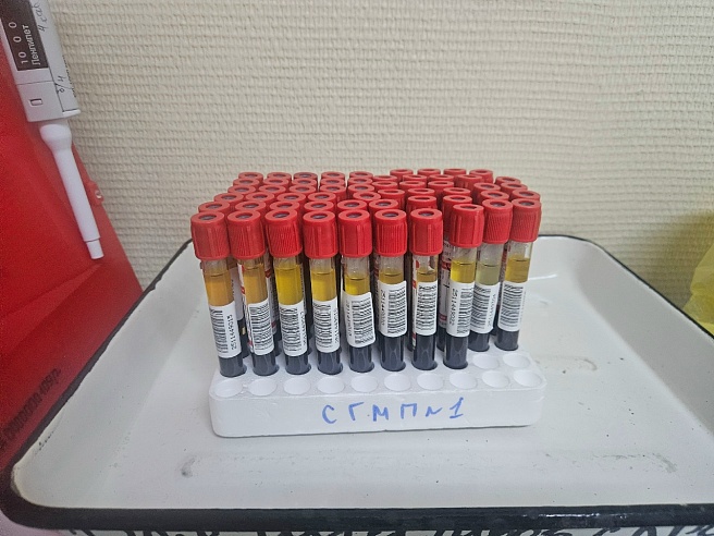 Ежегодно в Саратовской области выявляют в среднем от 400 до 600 новых случаев ВИЧ