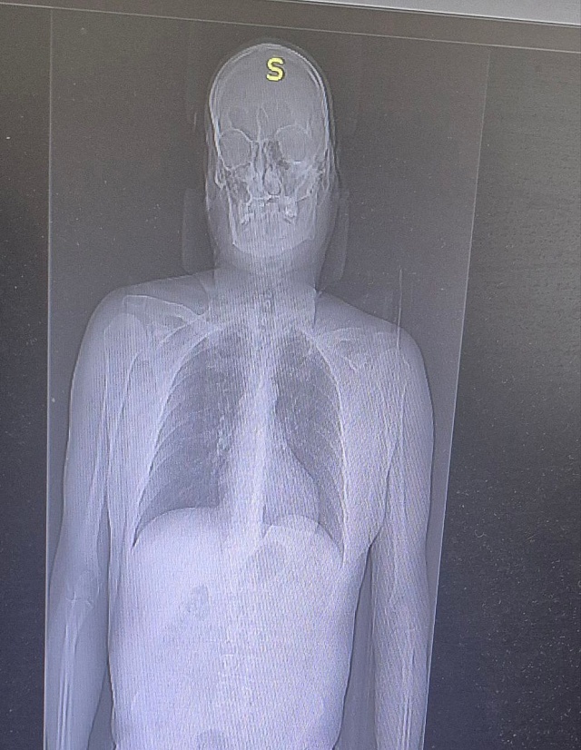 Балаковец упал с "Эйфелевой башни", но остался жив