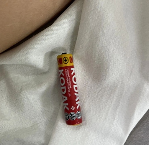 Балаковские врачи спасли двух проглотивших батарейки детей